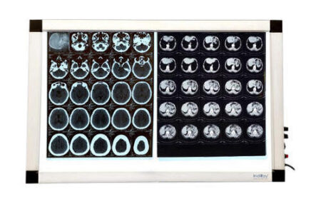 Indiray Medical X-ray Film Viewer – LED